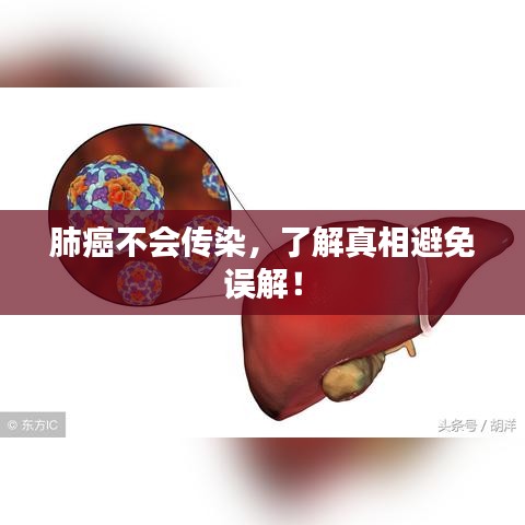 肺癌不会传染，了解真相避免误解！