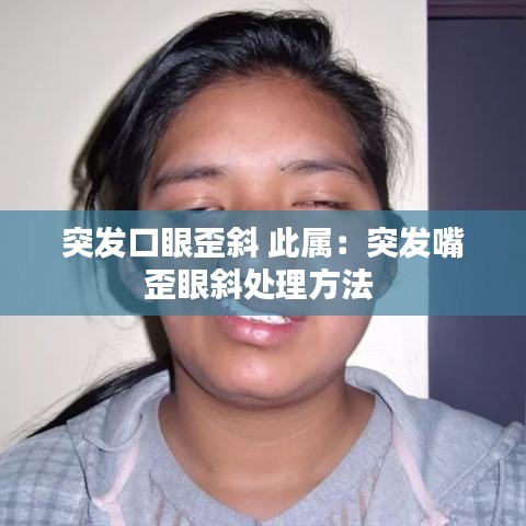 突发口眼歪斜 此属：突发嘴歪眼斜处理方法 