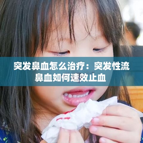 突发鼻血怎么治疗：突发性流鼻血如何速效止血 