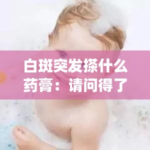 白斑突发搽什么药膏：请问得了白斑擦什么药膏 