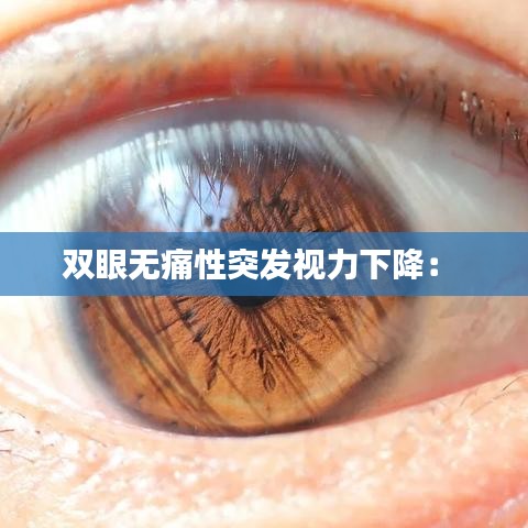 双眼无痛性突发视力下降： 