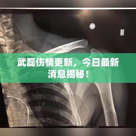 武磊伤情更新，今日最新消息揭秘！