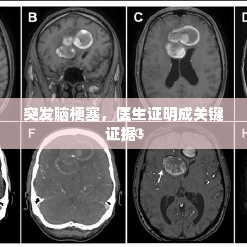 突发脑梗塞，医生证明成关键证据！